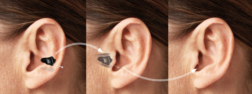 Phonak Titanium - Vorteilhaft Leben - Vorteilhaft Leben