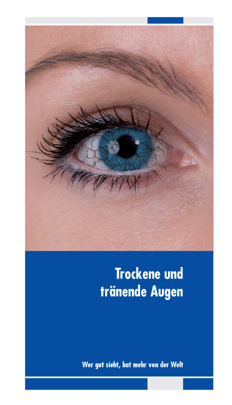 Trockenes Auge - Vorteilhaft Leben - Vorteilhaft Leben
