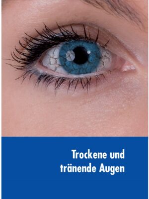 Trockenes Auge 002neu - Vorteilhaft Leben - Vorteilhaft Leben